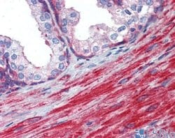 MYL6 Rabbit anti-Human, Polyclonal, Novus Biologicals:Antibodies:Primary